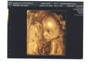 Ultrasound 11-3-14 001ed